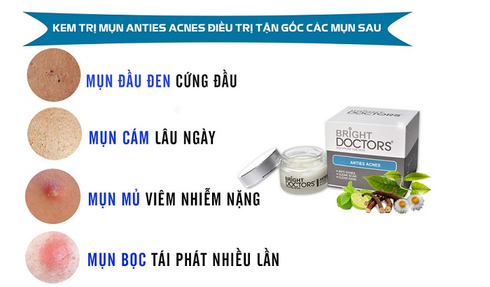 kem tri mun tan goc