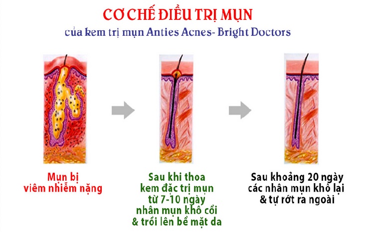 nguyen-ly-tri-mun-bright-doctors